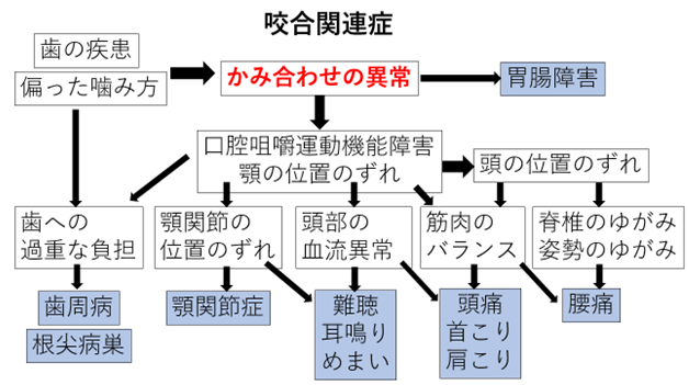 咬合関連症にはどのような症状がありますか