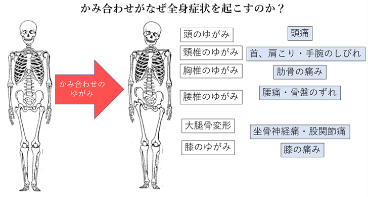 噛み合わせがなぜ全身症状を起こすのか?